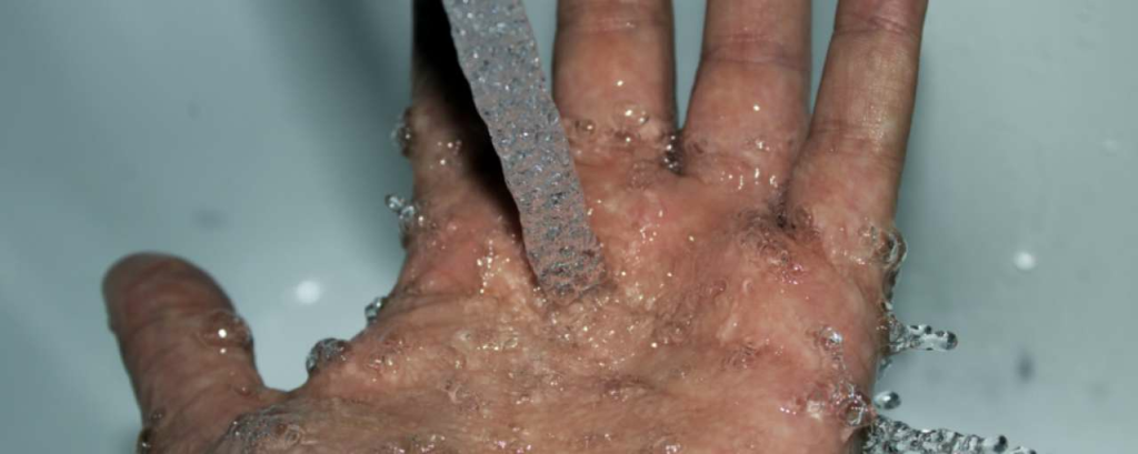 Washing hands