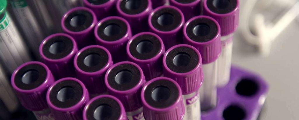 Blood test tubes 2