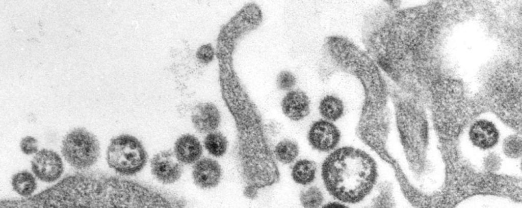 Lassa virus