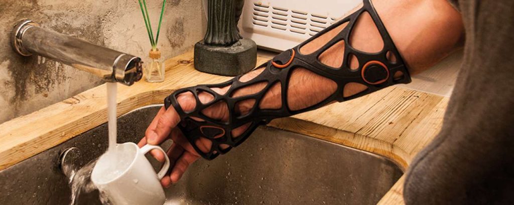 3d geprint gipsverband 1