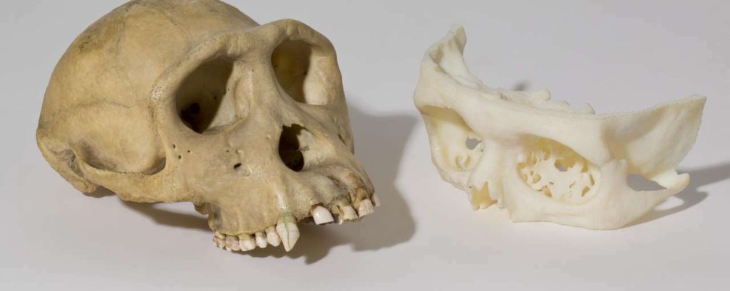 Bottransplantatie