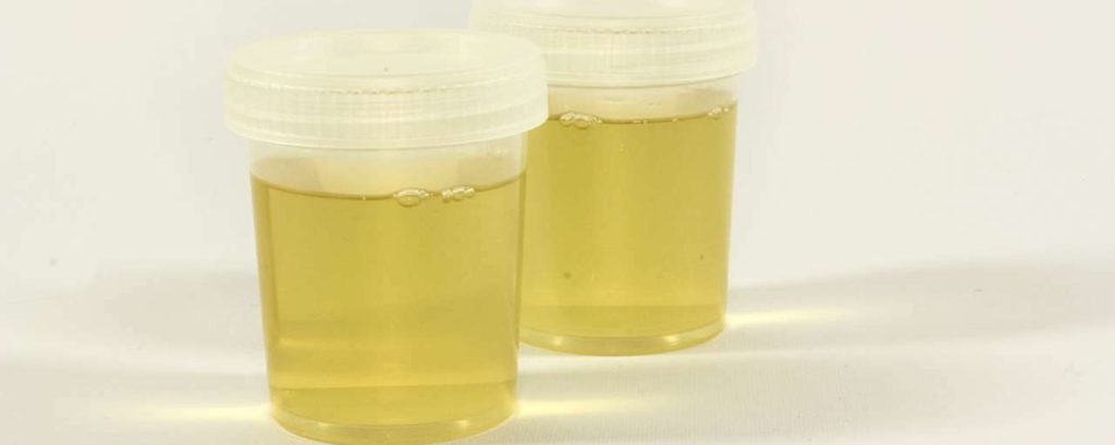Urine brandstof