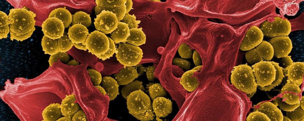 Antibioticaresistentie bestrijden