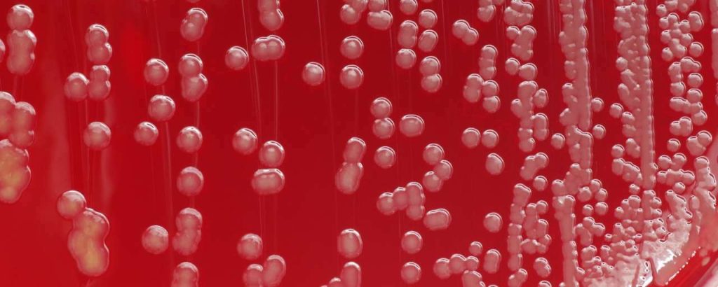 Bacteria