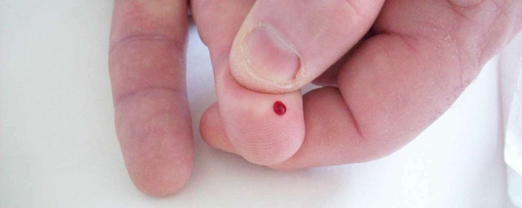 Bloedtest diabetes