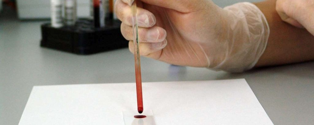 Bloedonderzoek diagnose duurzaam